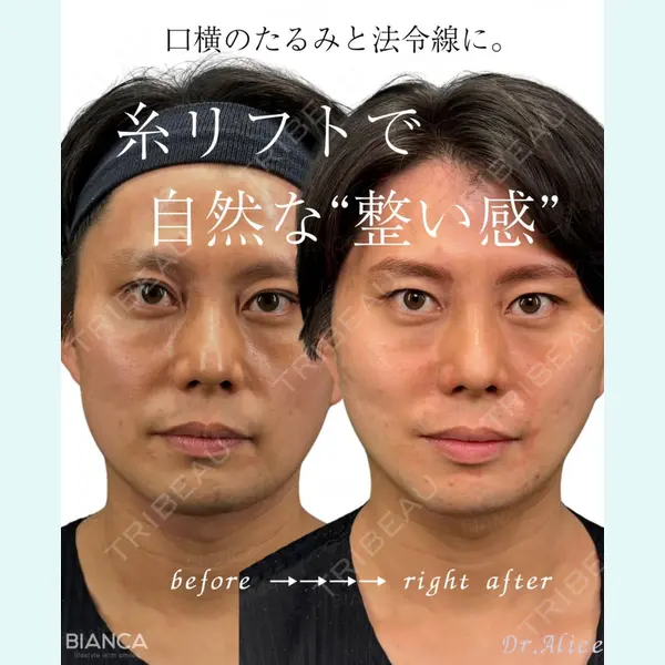 BIANCA銀座 幡手 亜梨子医師の症例