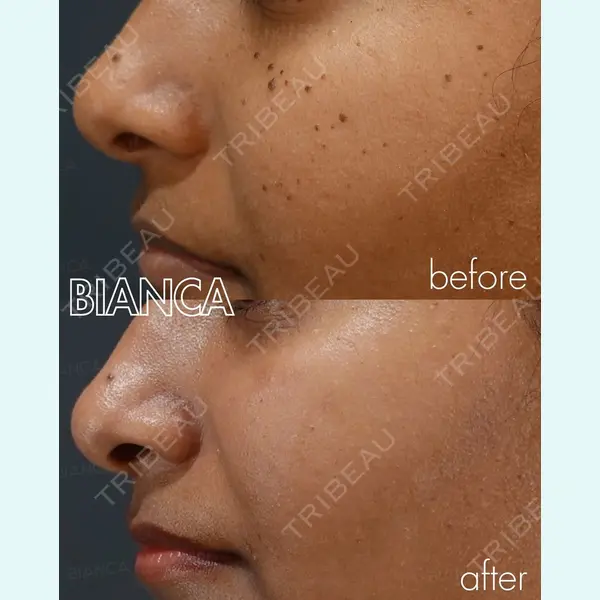 BIANCA銀座 葉山 愛弥医師の症例