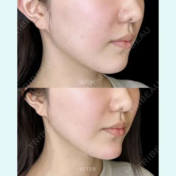 ルラ美容クリニック 大宮院 / ルラスキンクリニック 大宮院 右京 大季医師の症例