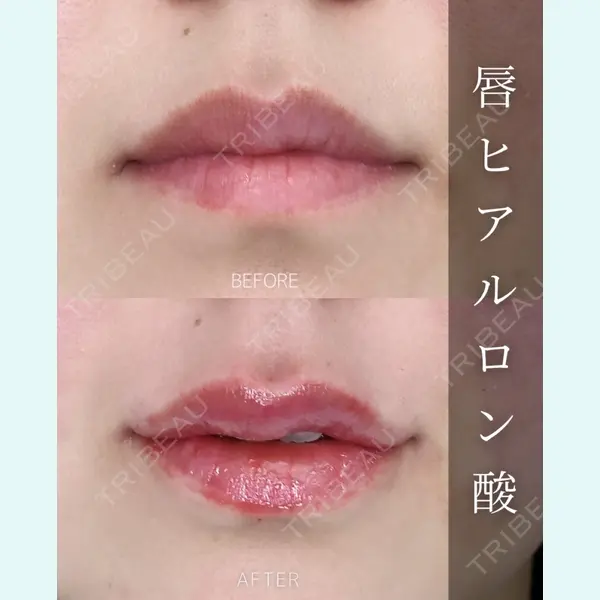 ルラ美容クリニック 大宮院 / ルラスキンクリニック 大宮院 右京 大季医師の症例