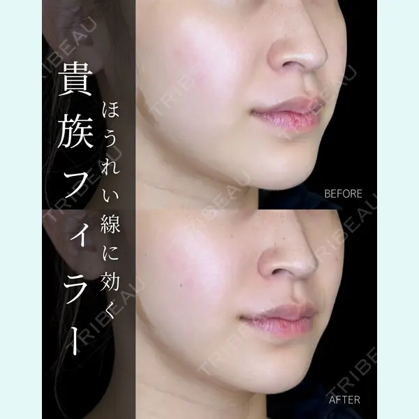 ルラ美容クリニック 大宮院 / ルラスキンクリニック 大宮院 右京 大季医師の症例