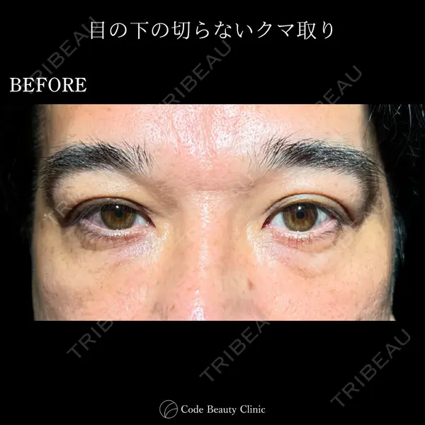 Code Beauty Clinic 名古屋院 橋本 祥平医師の症例