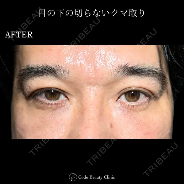 Code Beauty Clinic 名古屋院 橋本 祥平医師の症例