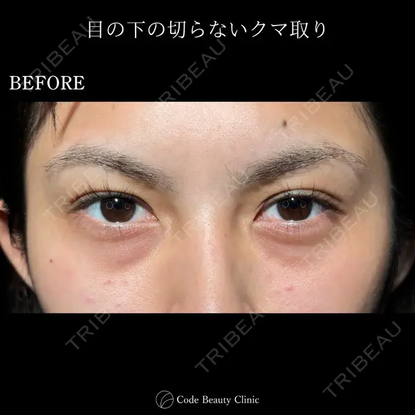 Code Beauty Clinic 名古屋院 橋本 祥平医師の症例