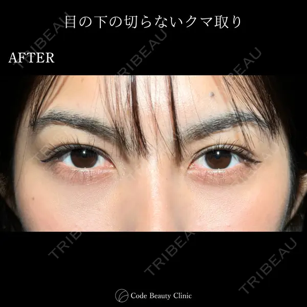 Code Beauty Clinic 名古屋院 橋本 祥平医師の症例