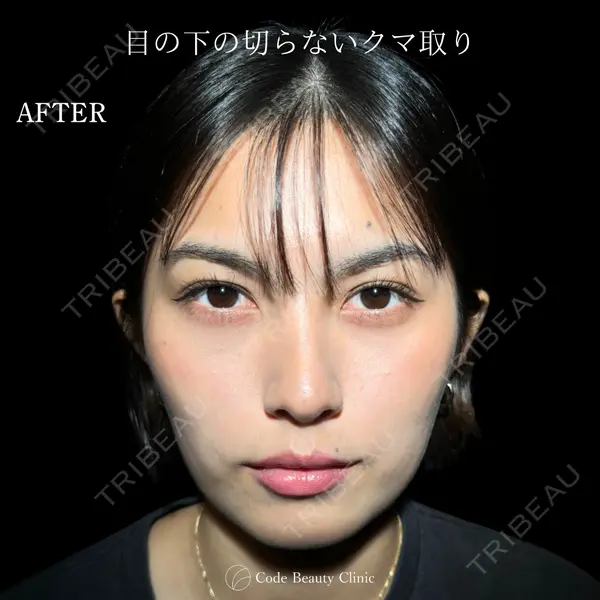 Code Beauty Clinic 名古屋院 橋本 祥平医師の症例