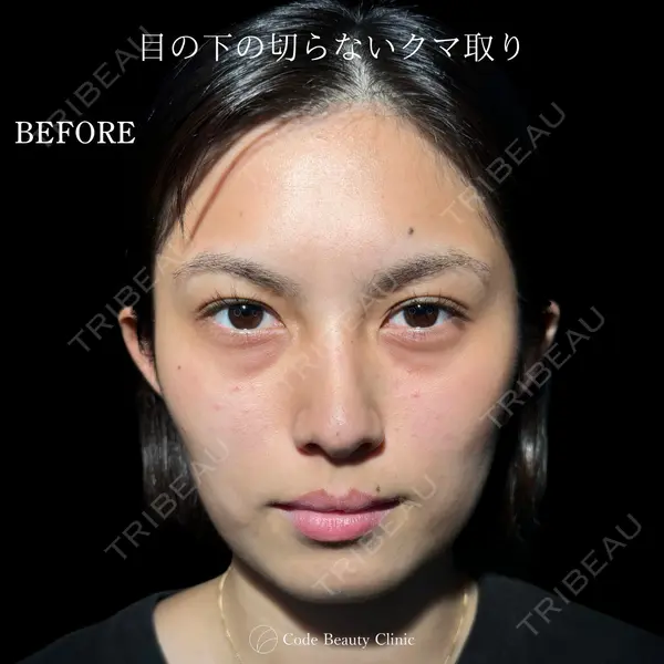 Code Beauty Clinic 名古屋院 橋本 祥平医師の症例