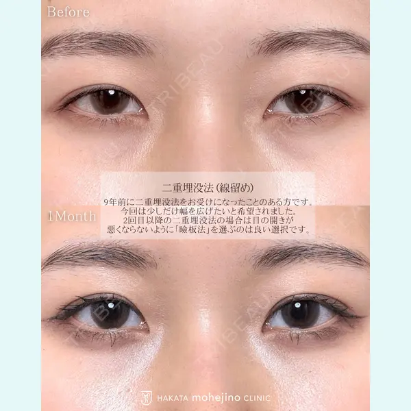 博多もへじのクリニック 村田 将光医師の症例