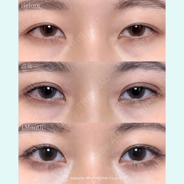 博多もへじのクリニック 村田 将光医師の症例