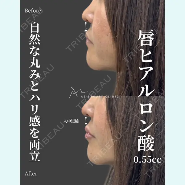 AZ BEAUTY CLINIC 木村 潤医師の症例