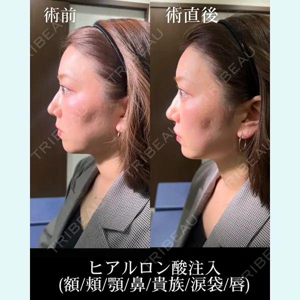 HAAB×DREAM BEAUTY CLINIC 大阪梅田院 錦 実奈医師の症例