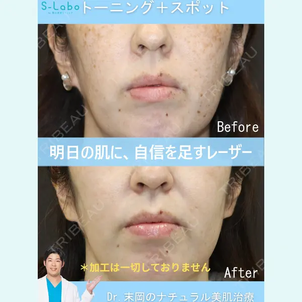 S-Laboクリニック 渋谷院 末岡 大輔医師の症例