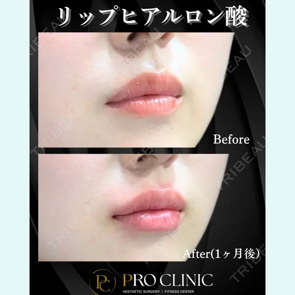 PRO CLINIC プロクリニック 銀座院 柚﨑 一輝医師の症例