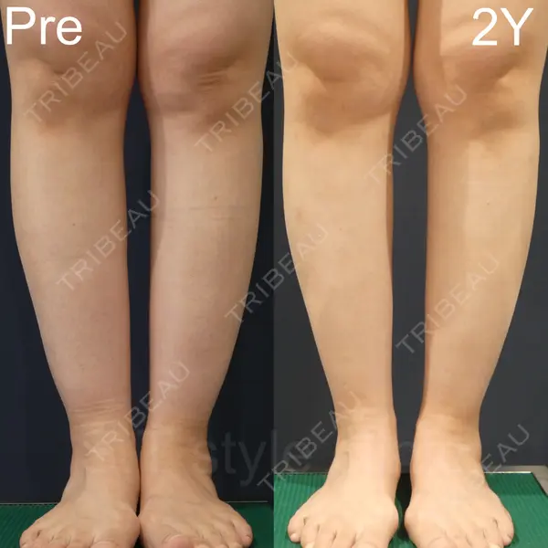 S.T styleクリニック 徳田 真紀子医師の症例