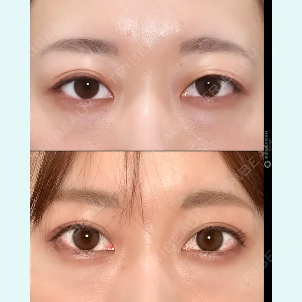 東京形成美容外科 池袋院 弓削田　浩主医師の症例