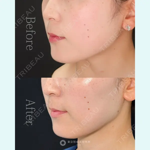 東京形成美容外科 池袋院 弓削田　浩主医師の症例