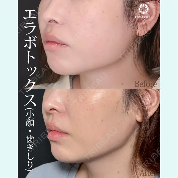 東京形成美容外科 池袋院 弓削田　浩主医師の症例