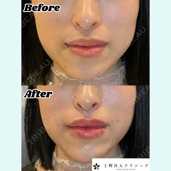 上野注入クリニックの症例