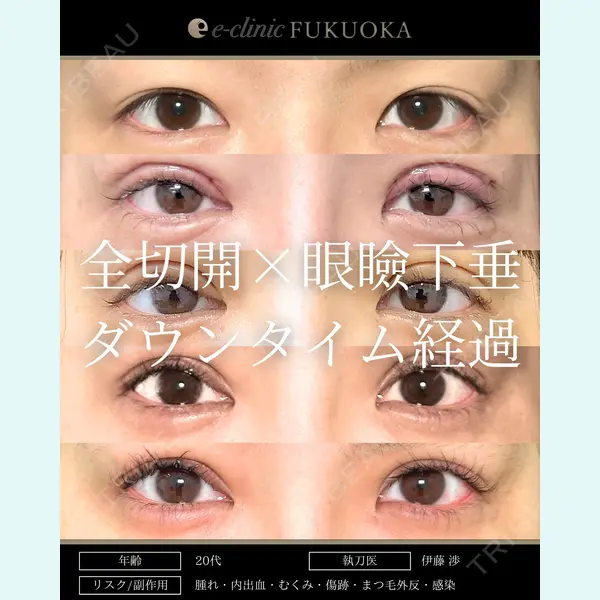 eクリニック 福岡院 伊藤 渉医師の症例