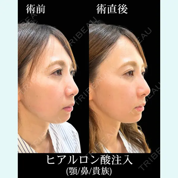 HAAB×DREAM BEAUTY CLINIC 東京本院 佐野 圭医師の症例