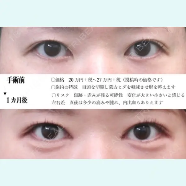 ドクター松井クリニック 新宿 松井　彰一郎医師の症例