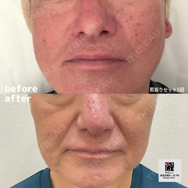 やさしい美容皮膚科・皮フ科　東京浅草院の症例