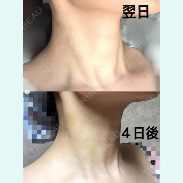 愛知春日井美容外科ネビュラクリニック 都築 諒医師の症例