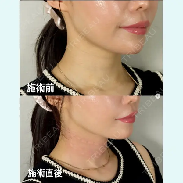 愛知春日井美容外科ネビュラクリニック 都築 諒医師の症例