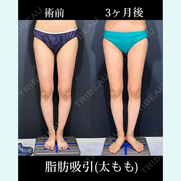 HAAB×DREAM BEAUTY CLINIC 東京本院 吉岡 修一医師の症例