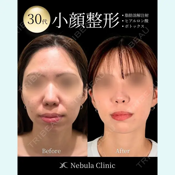 愛知春日井美容外科ネビュラクリニック 都築 諒医師の症例