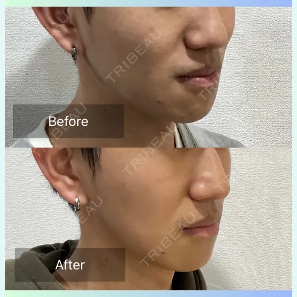 ビューティー和心クリニック 浅草院の症例