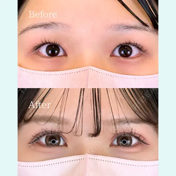 ルラ美容クリニック 広島院 角南 亮輔医師の症例