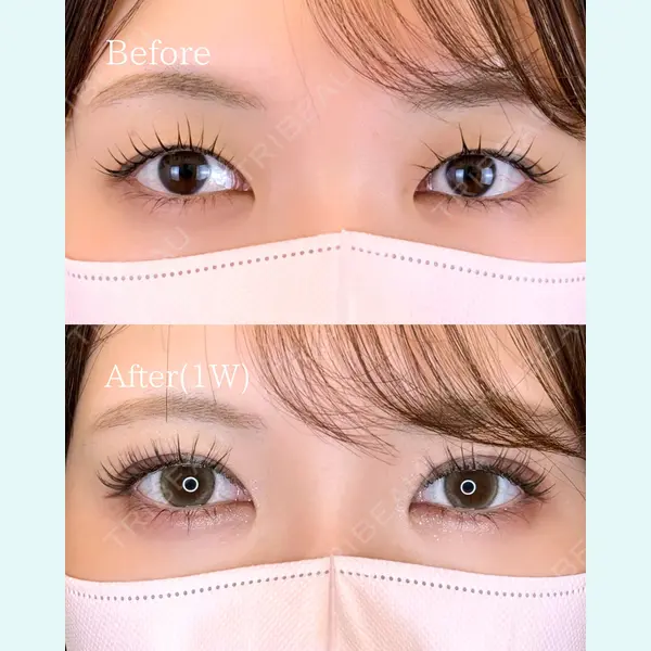 ルラ美容クリニック 広島院 角南 亮輔医師の症例