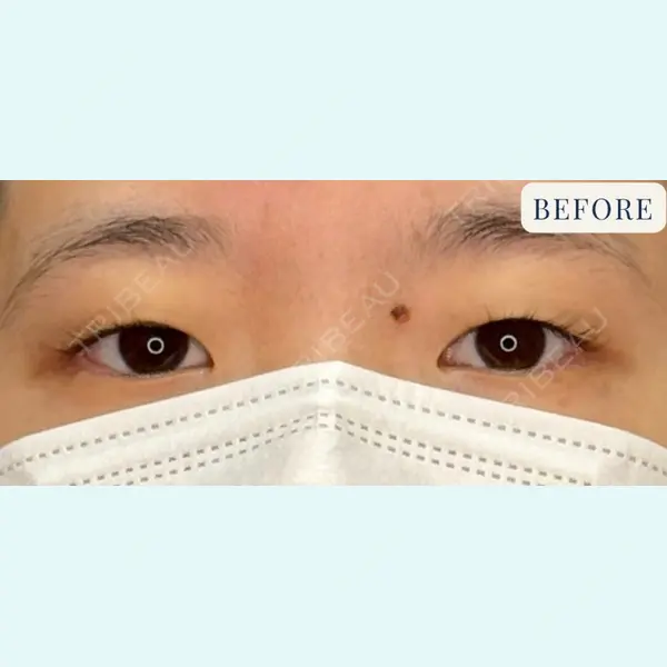 ピュアクリニック 西大寺院 小西 恒医師の症例