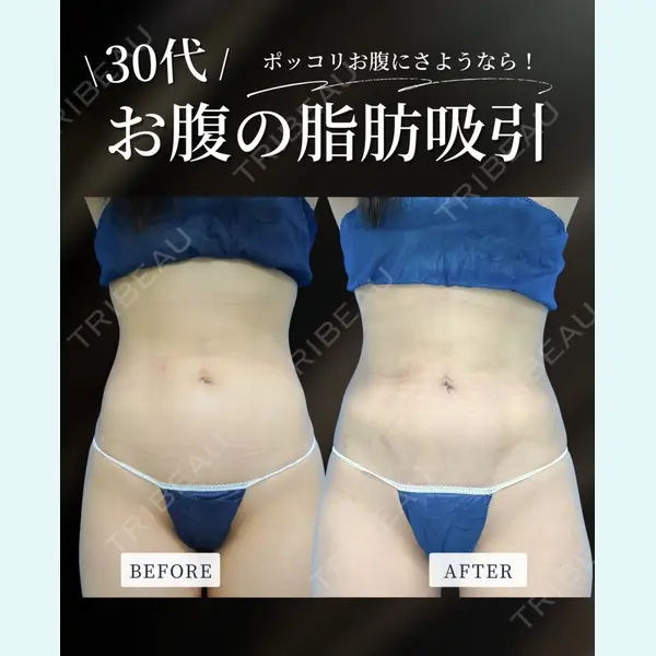 ガーデンクリニック 大阪院 松口 崇央医師の症例