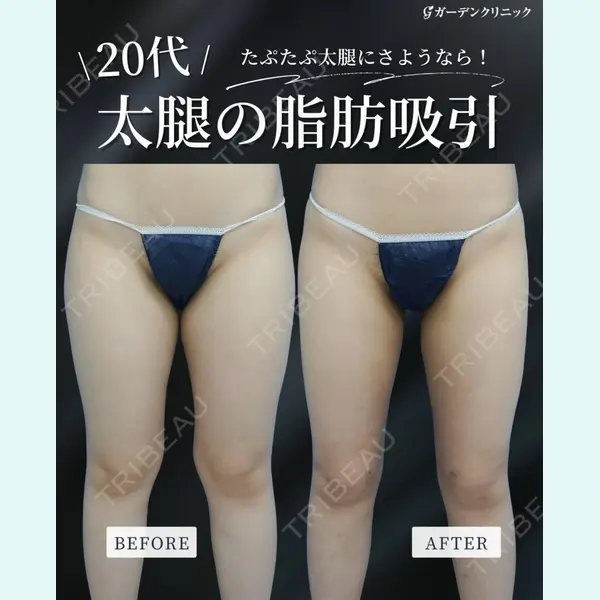 ガーデンクリニック 大阪院 松口 崇央医師の症例