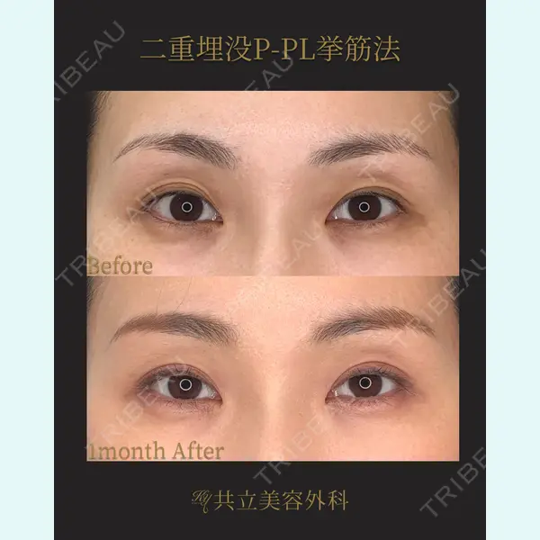 共立美容外科 新宿本院の症例