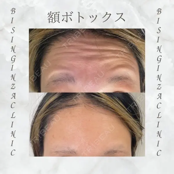 BISIN GINZA CLINICの症例