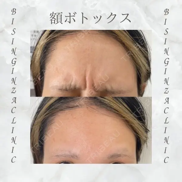 BISIN GINZA CLINICの症例