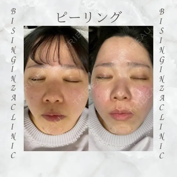 BISIN GINZA CLINICの症例