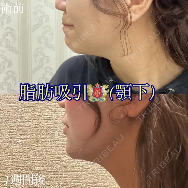 シャトークリニック 河合 秀紀医師の症例