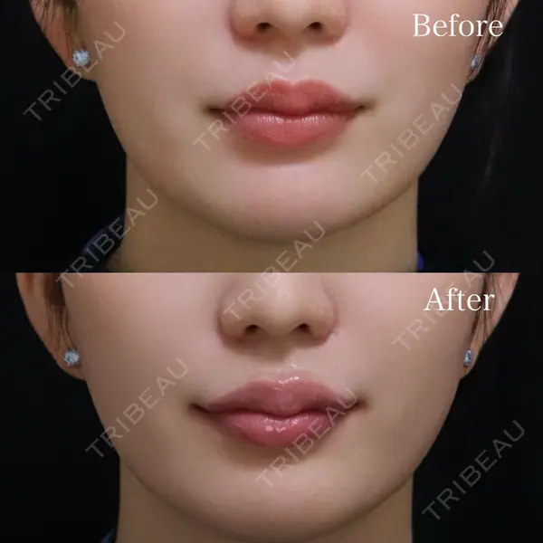 Wクリニック 福岡院 堂園 史子医師の症例