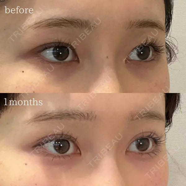 オーキッド美容クリニック東京御徒町 西浦 蘭子医師の症例