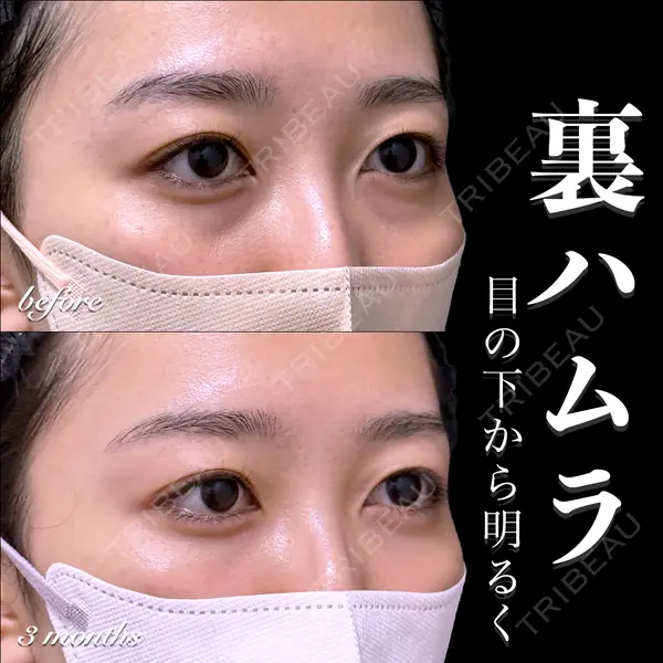EMMO FACE CLINIC 大宮院 百瀬 直也医師の症例