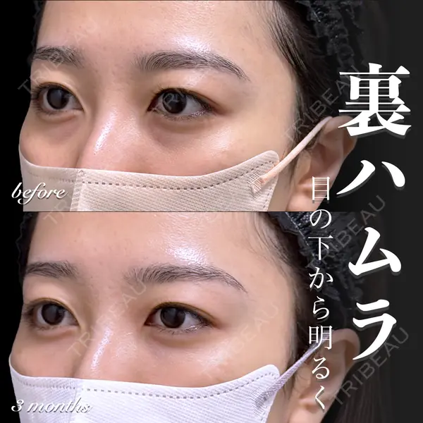 EMMO FACE CLINIC 大宮院 百瀬 直也医師の症例
