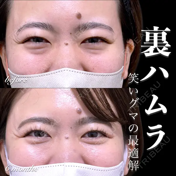 EMMO FACE CLINIC 大宮院 百瀬 直也医師の症例