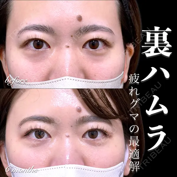 EMMO FACE CLINIC 大宮院 百瀬 直也医師の症例