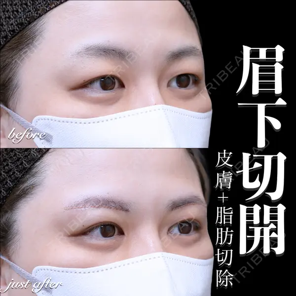 EMMO FACE CLINIC 大宮院 百瀬 直也医師の症例