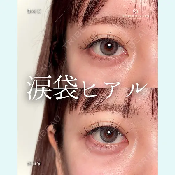 Moon Beauty Clinic 渡邉 正士医師の症例
