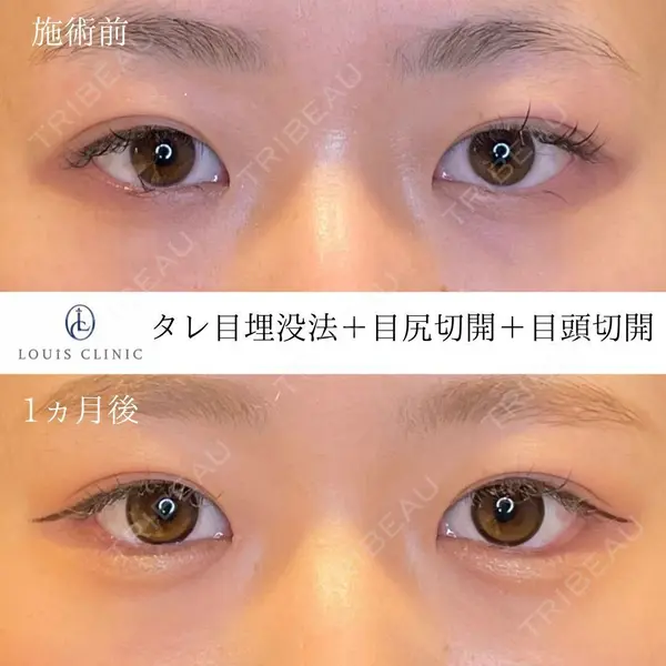 LOUIS CLINIC 二子玉川院【ルイクリニック】 小松 塁医師の症例